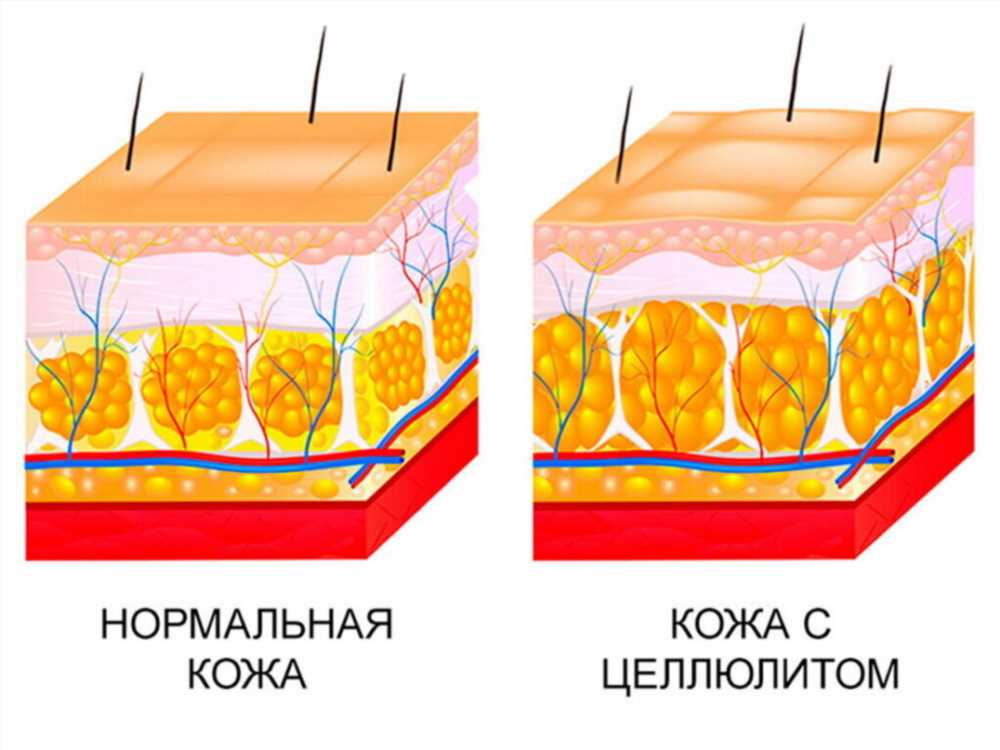 Борьба с холодными ногами: причины, риски и эффективные решения