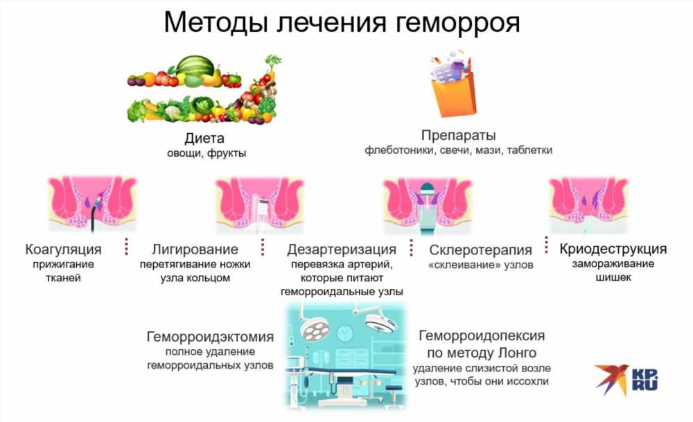 Эффективные народные методы лечения геморроя в домашних условиях: советы от специалистов