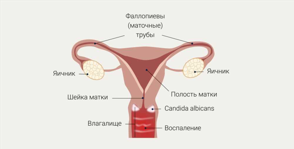 Как избавиться от вагинального запаха: советы и рекомендации для женщин