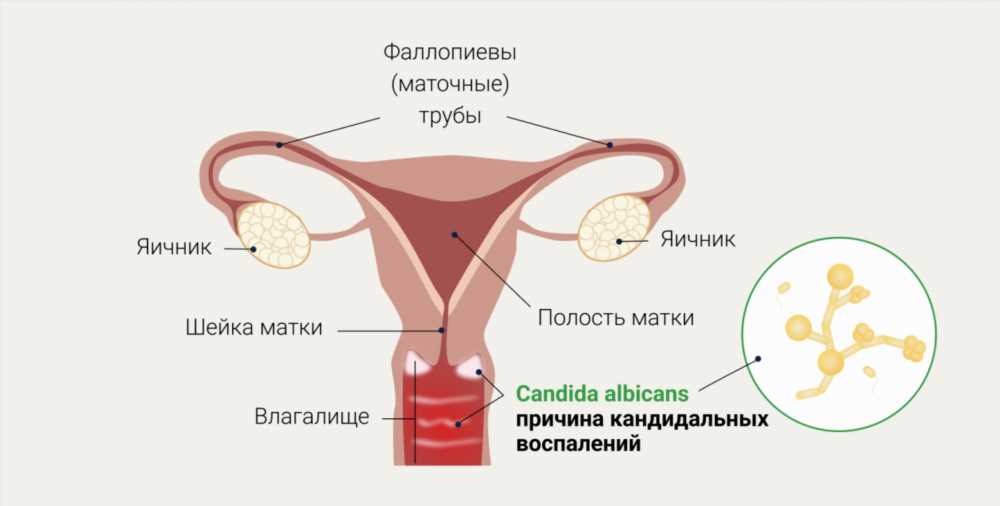 Как выбрать свечи для нормализации микрофлоры у женщин: руководство и рекомендации