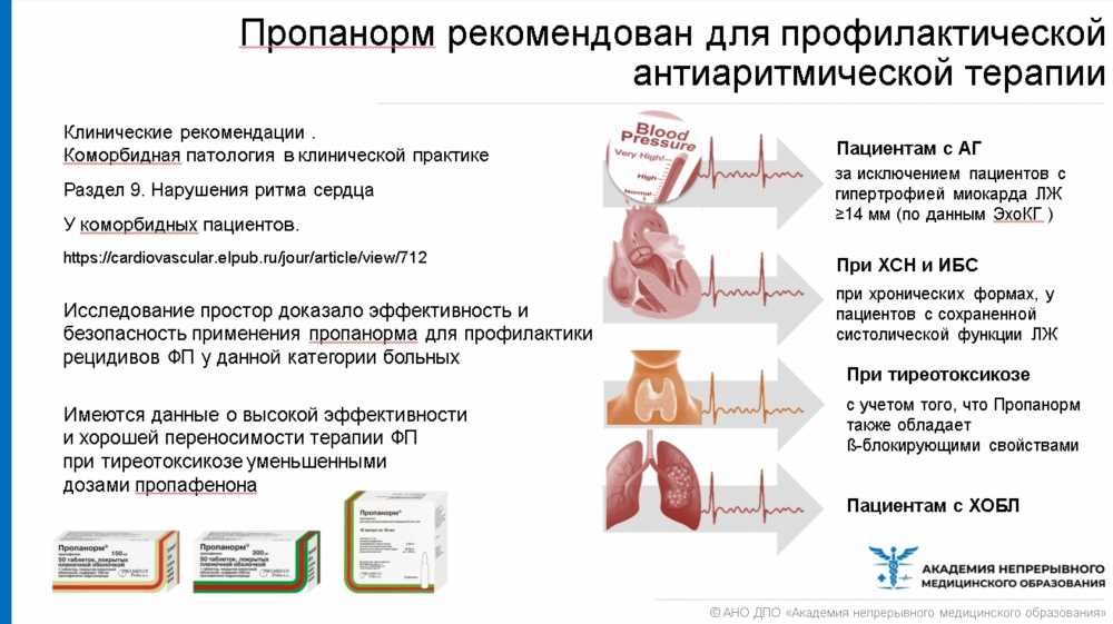 Лучшие сосудорасширяющие препараты для сердца: руководство по выбору и применению