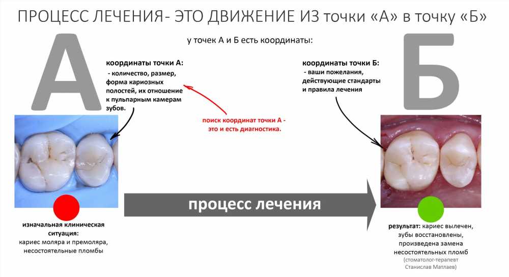 Основные аспекты терапевтической стоматологии: Все, что вам нужно знать