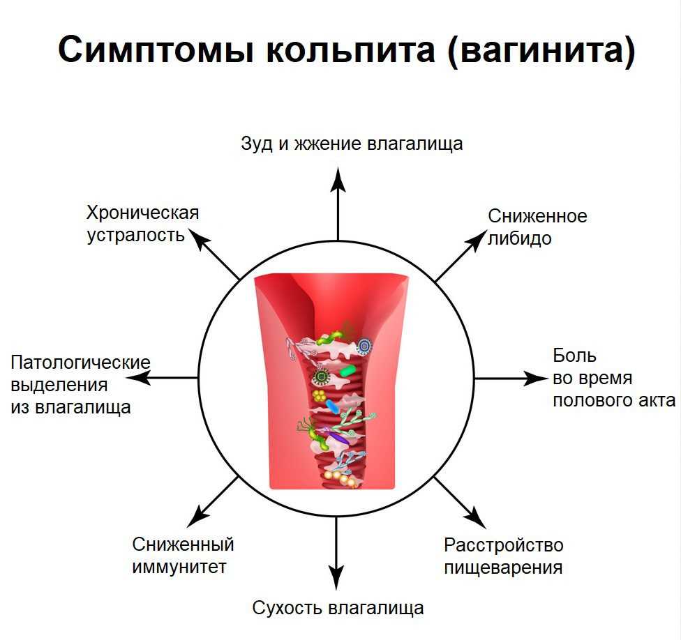 Почему у женщин возникают гнойные выделения: причины и способы лечения