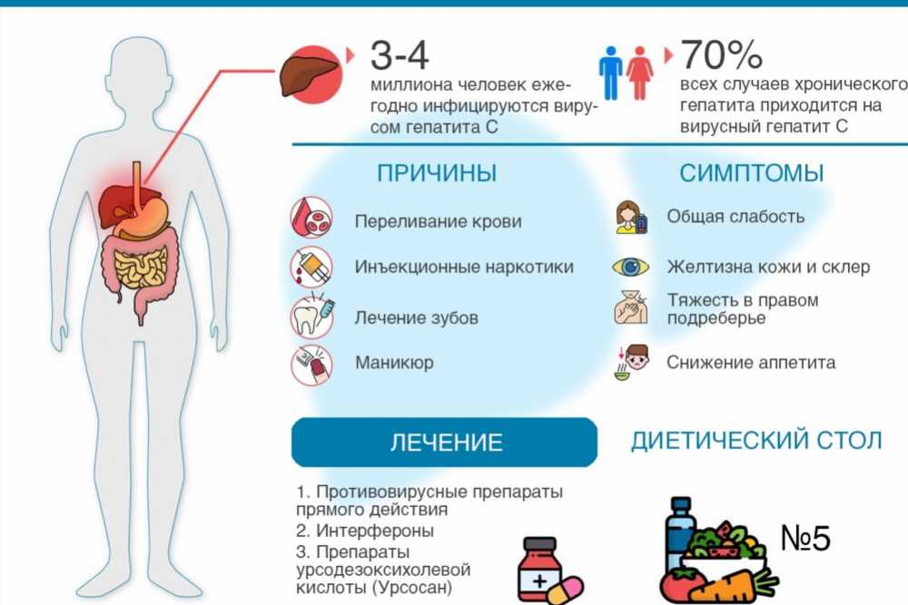 Все, что вам нужно знать о заболевании: причины, симптомы и методы лечения